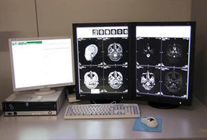 放射線科の読影端末。電子カルテ端末（左）と高輝度2MPの高精細モニタ2面で構成。電子カルテとPACSを1台の端末に搭載。