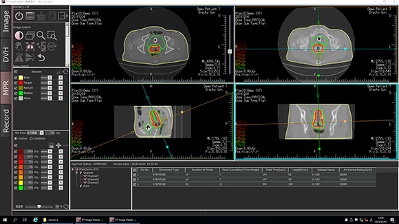 RT Image Viewer