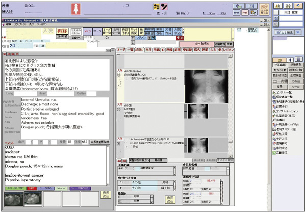 婦人科外来再診カルテ基本画面 左が所見入力，右が過去の記録の参照カラム。カーソルを合わせると画像が拡大する。