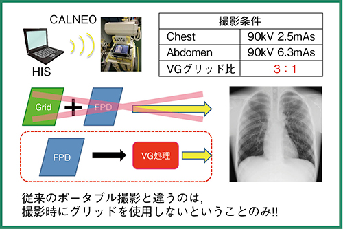 図1　Virtual Gridによる撮影条件とワークフロー