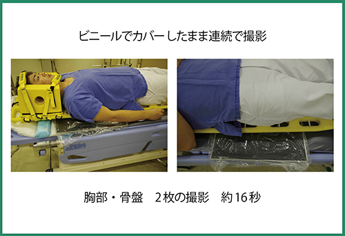 図1　FPDを用いたバックボード撮影