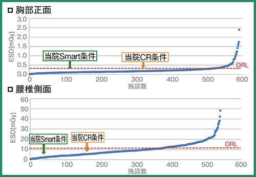 図2　全国デジタル装置との線量比較