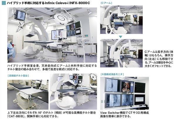 ハイブリッド手術に対応するInfinix Celeve-i INFX-8000C