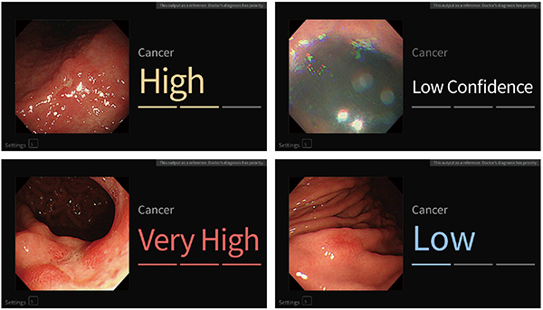 図2　内視鏡画像に対して，“がんの可能性”を鑑別する。