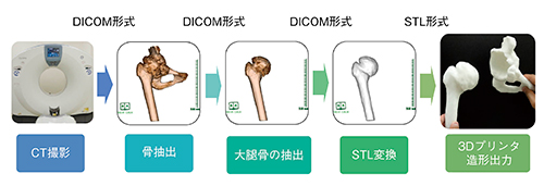 図3　THA術前シミュレーション用実物大立体モデルの作成工程