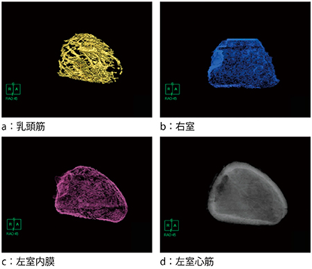 図4　左室内腔3DCT画像の各レイヤー