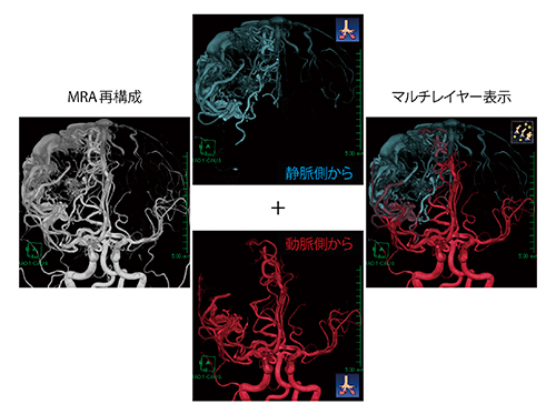 図1　簡易的feeder同定マルチレイヤー画像の作成方法