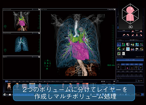 図2　マルチボリューム処理