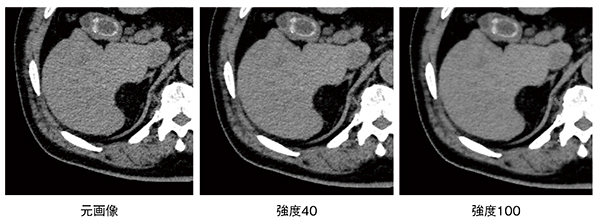 図2　ノイズ低減処理の強度を変えた画質の比較