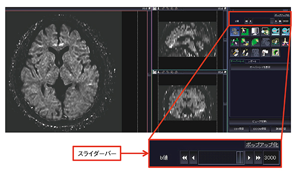 図1　cDWI作成画面