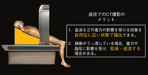 図1　下肢静脈瘤精査における撮影体位の工夫 主治医および患者とシミュレーションを行い，体に負担がなく，安全に撮影できることを確認して撮影を行った。