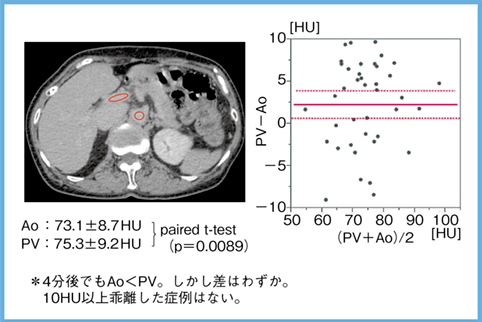 図4　造影CTの4分後平衡相での大動脈・門脈値（n＝40）