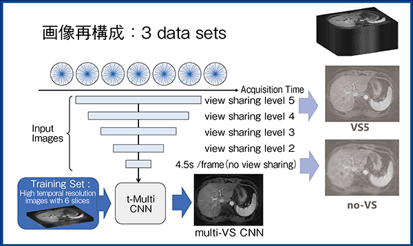 図4　t-Multi CNNによる画像再構成