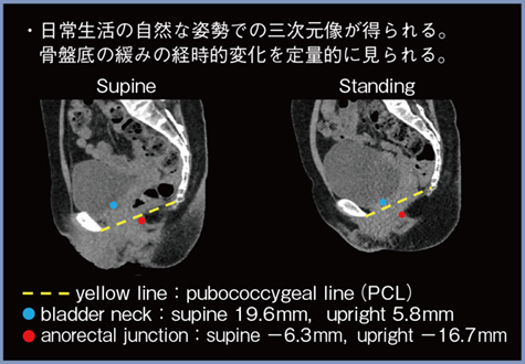 図4　骨盤底弛緩の経時的変化の測定