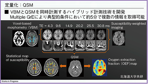 図1　VBMとQSMのハイブリッド計測技術