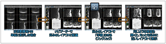 図1　SRPの設定方法