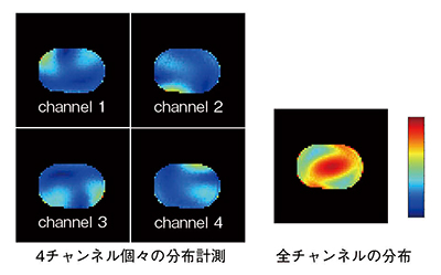 図5　独立4チャンネルB1map計測“Blink”の結果