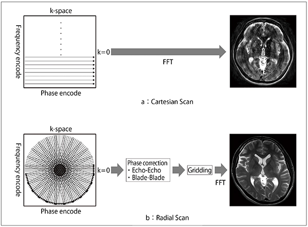 図1　Cartesian Scan（a）とRadial Scan（b）における画像再構成方法