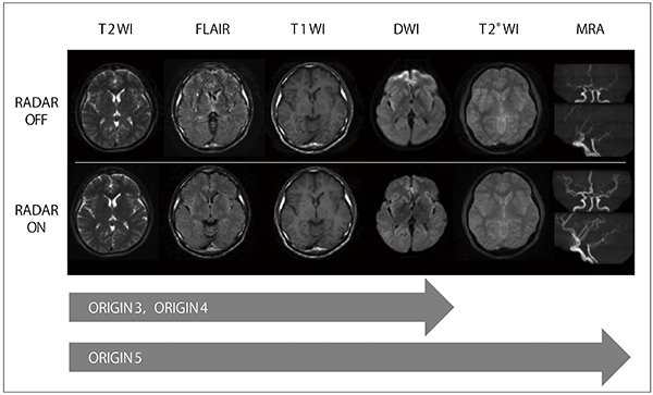 図3　RADAR適応シーケンスと画像