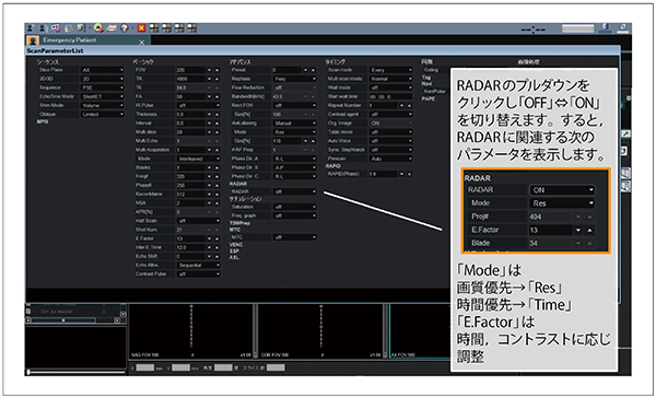 図4　RADARの設定方法