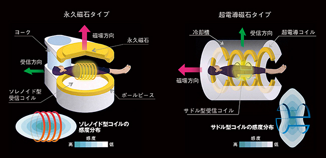 図2　磁場方向・コイル方式の違い