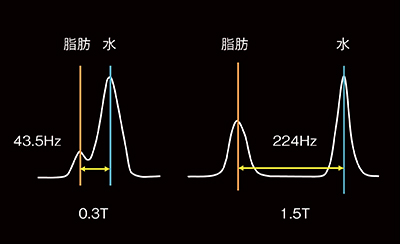 図3　水と脂肪の共鳴周波数の違い