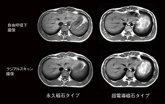 図4　腹部画像の違い