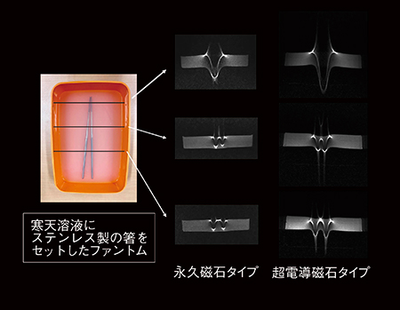 図5　金属画像の違い