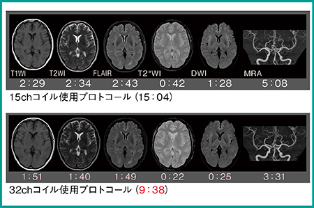 図1　32chコイルの高SNRを活用した撮像時間短縮