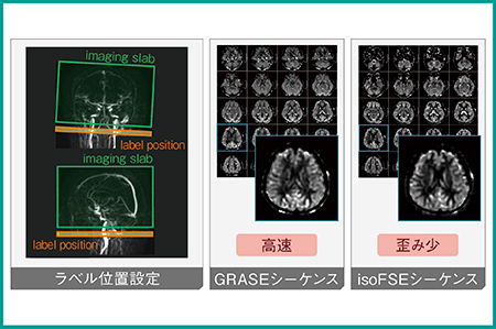 図2　PWIの特徴