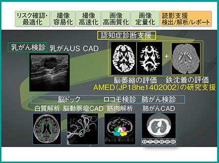 図5　読影支援機能の開発ロードマップ