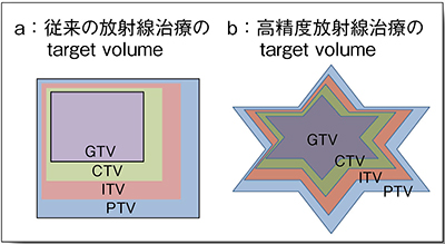 図1　放射線治療におけるtarget volumeの定義