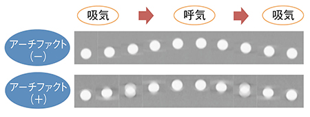 図4　動体ファントムを用いた精度評価結果