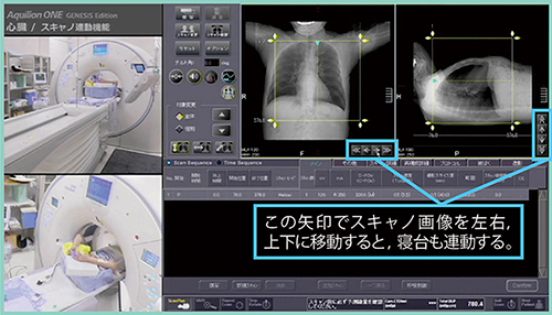 図6　スキャノ画像からの寝台連動機能