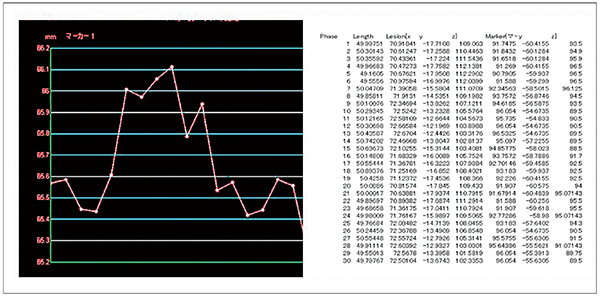 図4　4Dモーション解析結果のグラフ化とCSV出力の例