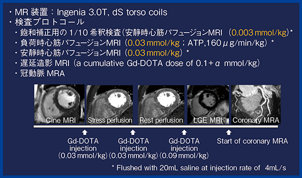 図2　‌当院における心臓MRIのプロトコール