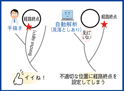 図5　細かい“CT枝読み”は大切2）