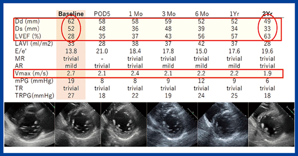 図3　症例1のTAVI後の心エコー検査の経過（2年間）