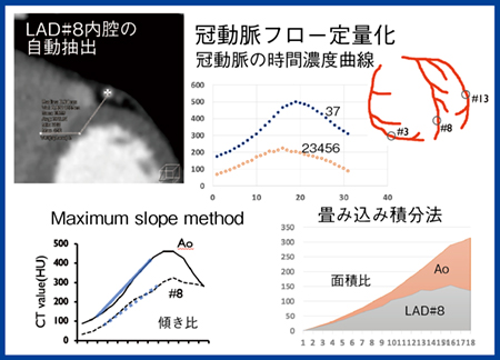 図4　4Dモーション解析による冠動脈フローの定量化