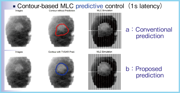 図2　従来法（a）と近未来予測に基づくMLC制御（b）