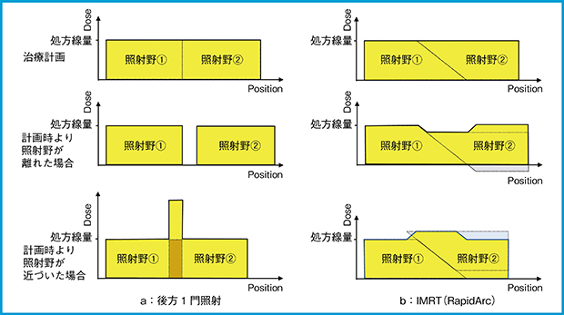 図1　1門照射（a）とRapidArc（b）における照射野のつなぎ目位置での線量イメージ 1門照射の場合，上下照射野の位置ズレによりつなぎ目の線量の変化が大きく，細心の注意が必要である。 上下の照射野をオバーラップさせたIMRT（RapidArc）では，上下の照射野の位置ズレの影響を少なくすることが可能である。