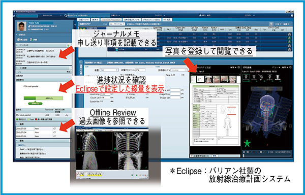 図4　患者情報はARIA OISで管理