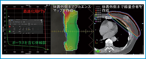 図3　最適化計算用structure setでの最適化計算