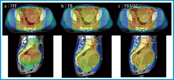 図3　Halcyonによる子宮頸がんの線量分布 a：FFF max：103.5%，min：69.1%，mean：91.4%，monitor unit（MU）：38.6/ 44.6/59.0/56.5 b：FB max：113.7%，min：90.4%，mean：101.2%，MU：92.7 /108.2/142.1/136.2 c：FB ＆ ISC max：109.6%，min：90.3%，mean：100.5%，MU：129.1 /138.6/ 95.6/114.1