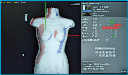 図2　体表面のモニタリングと位置ズレの表示