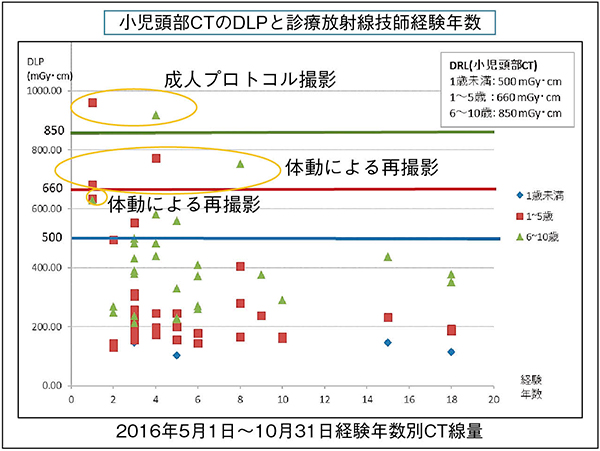 図3　小児CT検査における再撮影件数の把握