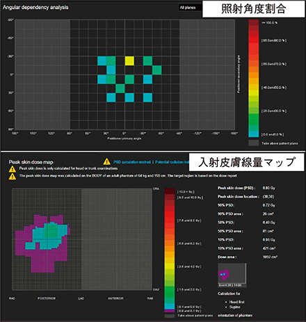 図2　照射角度割合および入射皮膚線量マップ