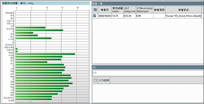 図4　臓器線量（例：胸部〜骨盤の単純CT）