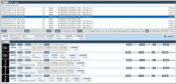 同一スタディ内で複数部位を撮影した場合の撮影内容の分離 一度のCT検査において複数部位が撮影された場合でも，部位ごとの分離が可能になった。本症例では，頭部位置決め撮影（側面）→頭部ヘリカル撮影→胸腹部位置決め撮影（正面）→胸腹部位置決め撮影（側面）→胸腹部ヘリカル撮影の順に実施しているが，頭部と胸腹部別々にCTDIvol，DLP，SSDEなどが表示されている。分離したおのおのを統計解析に用いることもできる。