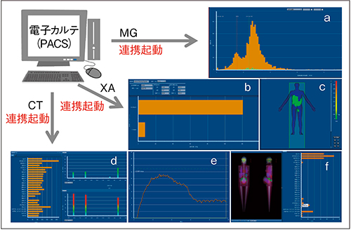 図1　どこでもRadimetricの連携図 a：マンモグラフィの相対位置，b：血管撮影装置の撮影線量と透視線量，c：入射皮膚線量マップ，d：検査ごとの照射線量と造影剤投与量と臓器線量，e：造影剤注入圧波形，f：モンテカルロシミュレーションによる推定臓器線量